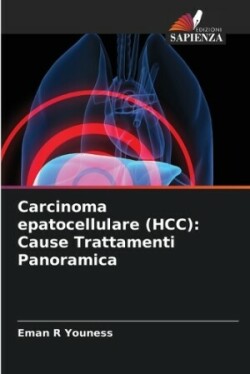 Carcinoma epatocellulare (HCC)