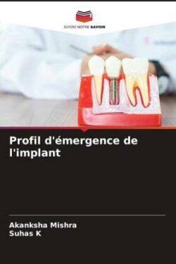 Profil d'émergence de l'implant