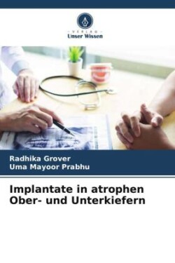 Implantate in atrophen Ober- und Unterkiefern