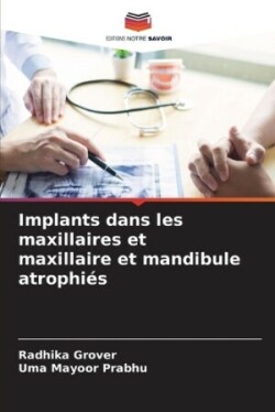 Implants dans les maxillaires et maxillaire et mandibule atrophiés