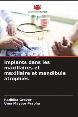 Implants dans les maxillaires et maxillaire et mandibule atrophiés