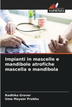 Impianti in mascelle e mandibole atrofiche mascella e mandibola