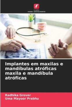 Implantes em maxilas e mandíbulas atróficas maxila e mandíbula atróficas