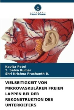 Vielseitigkeit Von Mikrovaskulären Freien Lappen Bei Der Rekonstruktion Des Unterkiefers