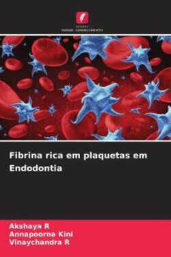 Fibrina rica em plaquetas em Endodontia