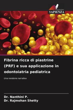 Fibrina ricca di piastrine (PRF) e sua applicazione in odontoiatria pediatrica