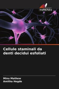 Cellule staminali da denti decidui esfoliati