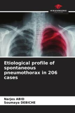 Etiological profile of spontaneous pneumothorax in 206 cases