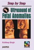 Step by Step Ultrasound of Fetal Anomalies