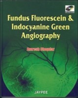 Fundus Fluorescien and Indocyanine Green Angiography