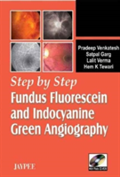 Step by Step® Fundus Fluorescein and Indocyanine Green Angiography