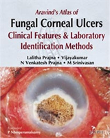 Aravind's Atlas of Fungal Corneal Ulcers