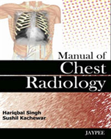 Manual of Chest Radiology