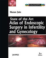 State of Art Atlas of Endoscopic Surgery