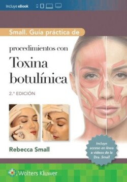 Small. Guía práctica de procedimientos con toxina botulínica