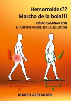 ¿Hemorroides? ¡Marcha de la bola!