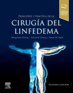 Principios y práctica de la cirugía del linfedema