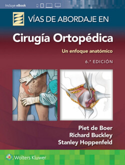 Vías de abordaje de cirugía ortopédica 6ª Ed. 2022