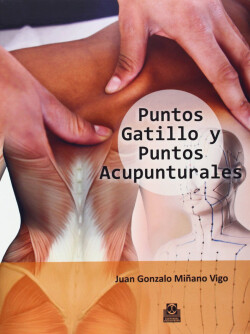 Puntos gatillo y puntos acupunturales