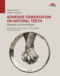Adhesive cementation on natural teeth - Materials and techniques