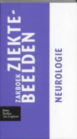 Zakboek ziektebeelden Neurologie