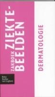 Zakboek ziektebeelden - Dermatologie