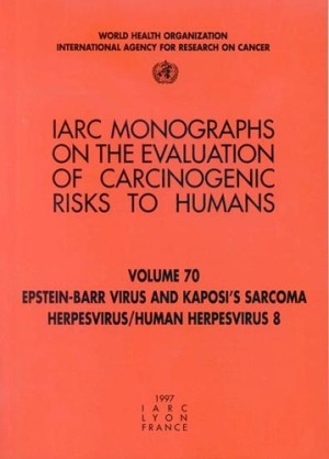 Epstein-Barr virus and Kaposi's Sarcoma Herpesvirus/Human Herpesvirus 8