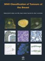 WHO - Classification of Tumours of the Breast, 4th Ed.