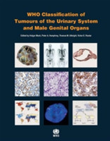 WHO - Classification of Tumours of the Urinary System and Male Genital Organs, 4th Ed.