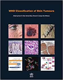 WHO - Classification of Skin Tumours 4th edit.