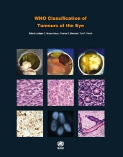 WHO - Classification of Tumours of the Eye, 4th ed.