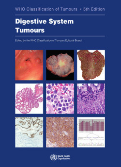 WHO - Classification of Tumours of the Digestive System, 5th Ed.