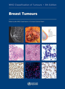 WHO - Classification of Tumours of the Breast, 5th Ed.