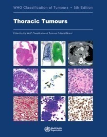 WHO - Classification of Thoracic Tumors, 5th ed.
