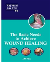 Basic Needs to Achieve Wound Healing