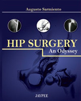 Hip Surgery
