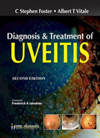 Diagnosis and Treatment of Uveitis