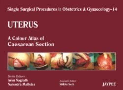 Single Surgical Procedures in Obstetrics and Gynaecology - Volume 14 - Uterus