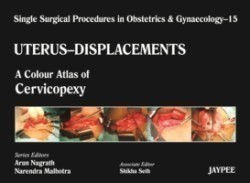 Single Surgical Procedures in Obstetrics and Gynaecology - Volume 15 - UTERUS - DISPLACEMENTS