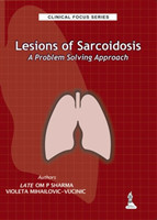Clinical Focus Series: Lesions of Sarcoidosis