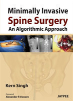 Minimally Invasive Spine Surgery: An Algorithmic Approach