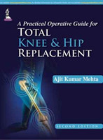 Practical Operative Guide for Total Knee and Hip Replacement, 2nd Ed.