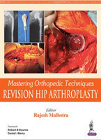 Mastering Orthopedic Techniques: Revision Total Hip Arthroplasty