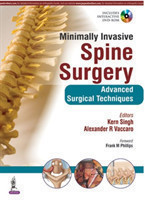 Minimally Invasive Spine Surgery