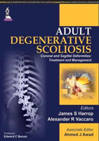 Adult Degenerative Scoliosis