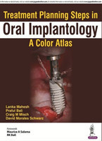 Treatment Planning Steps in Oral Implantology