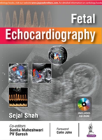 Fetal Echocardiography