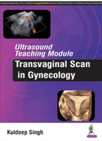 Ultrasound Teaching Module: Transvaginal Scan in Gynecology