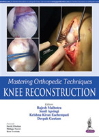 Mastering Orthopedic Techniques: Knee Reconstruction
