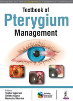 Textbook of Pterygium Management